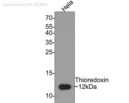HUABIO ET1703-03 image 1