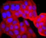 HUABIO ET1703-03 image 2