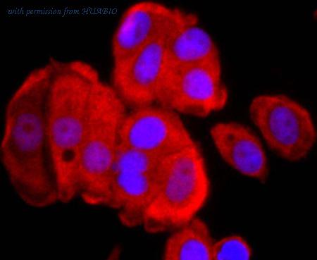 HUABIO ET1703-03 image 3