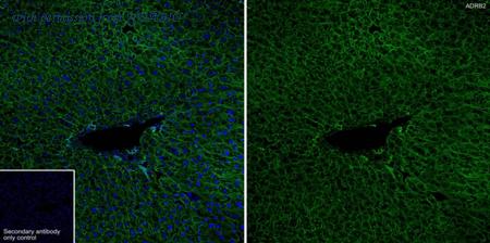 HUABIO ET1703-04 image 1