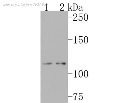 HUABIO ET1703-06-50UL image 1