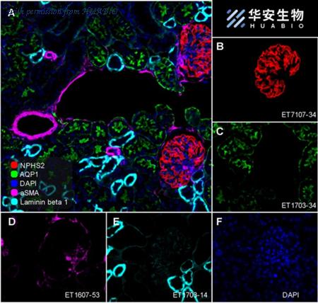 HUABIO ET1703-14 image 3