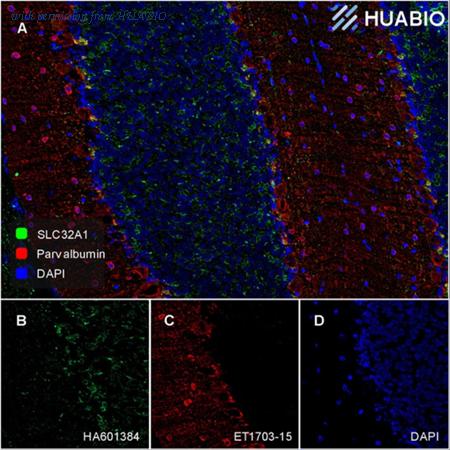 HUABIO ET1703-15 image 1