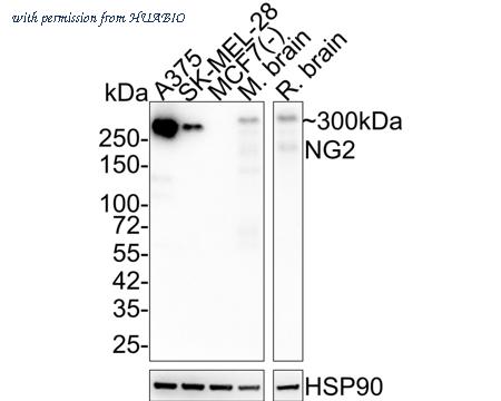 HUABIO ET1703-16-50UL image 1