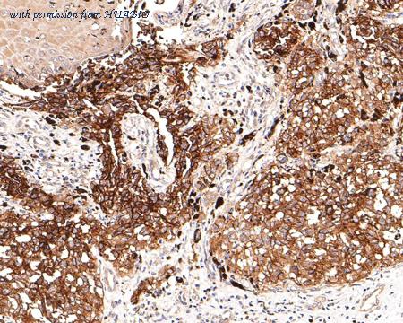 HUABIO ET1703-16-50UL image 3