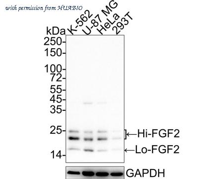 HUABIO ET1703-18 image 1