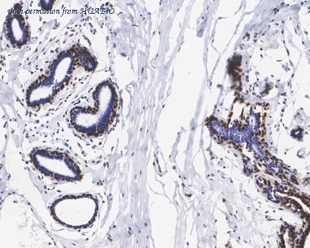 HUABIO ET1703-18 image 2