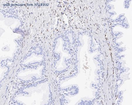 HUABIO ET1703-18 image 3