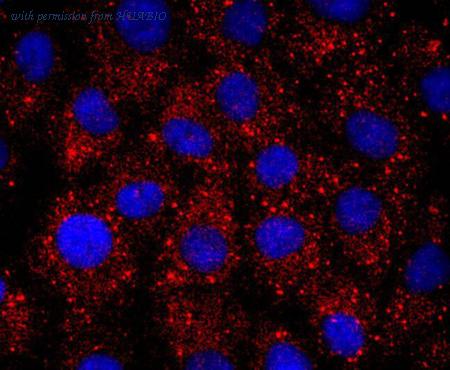 HUABIO ET1703-19 image 3