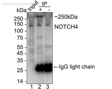 HUABIO ET1703-20 image 2
