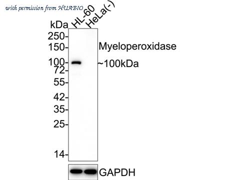 HUABIO ET1703-21 image 1