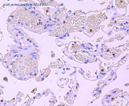 HUABIO ET1703-21 image 2