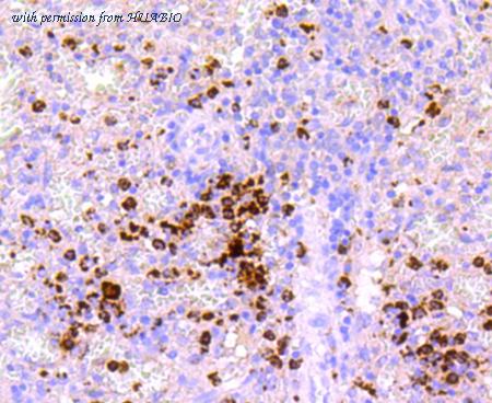 HUABIO ET1703-21 image 3