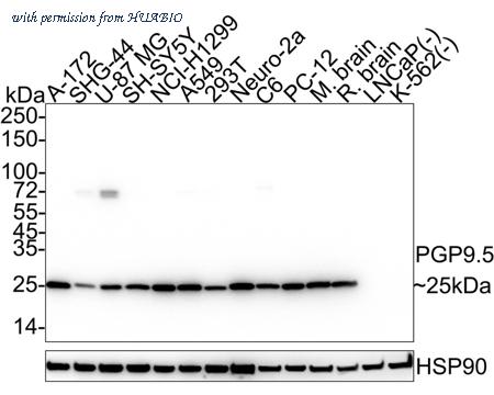 HUABIO ET1703-22-50UL image 1
