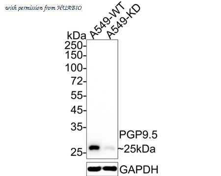 HUABIO ET1703-22-50UL image 2