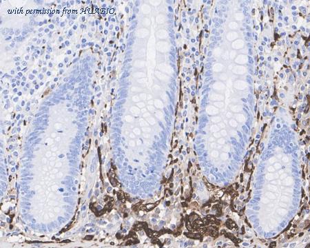 HUABIO ET1703-22-50UL image 3