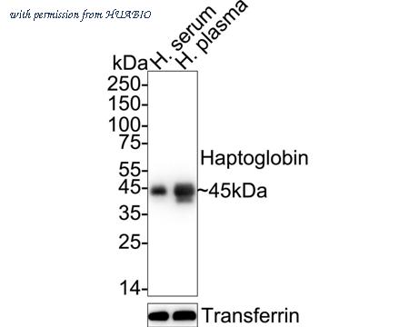 HUABIO ET1703-24 image 1