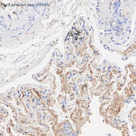 HUABIO ET1703-24 image 3