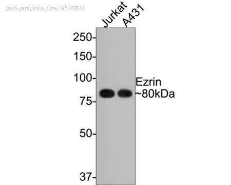 HUABIO ET1703-25 image 1
