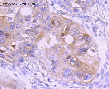 HUABIO ET1703-25 image 3