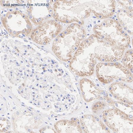 HUABIO ET1703-26 image 2