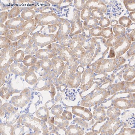 HUABIO ET1703-26 image 3