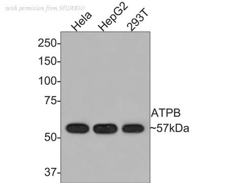 HUABIO ET1703-29 image 1