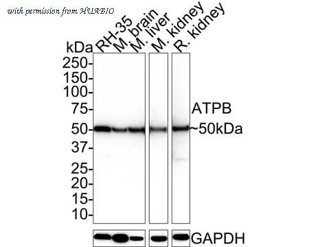 HUABIO ET1703-29 image 2