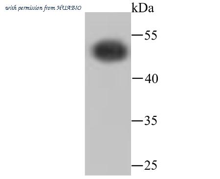 HUABIO ET1703-29 image 3