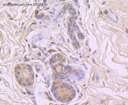 HUABIO ET1703-33 image 2