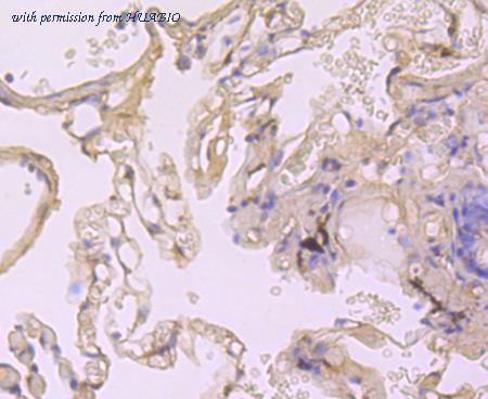 HUABIO ET1703-33 image 3