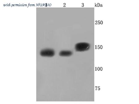 HUABIO ET1703-35 image 1