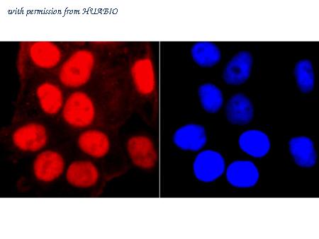 HUABIO ET1703-35 image 2