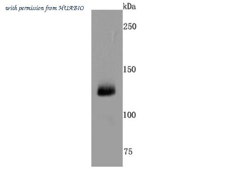 HUABIO ET1703-37 image 1