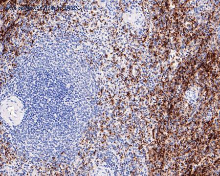 HUABIO ET1703-37 image 3