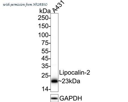 HUABIO ET1703-39 image 1