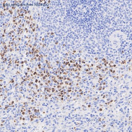 HUABIO ET1703-39 image 2