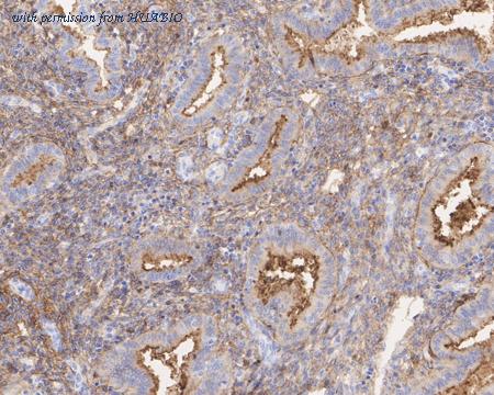 HUABIO ET1703-41 image 3