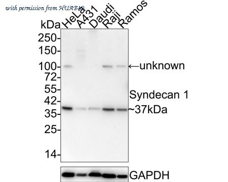 HUABIO ET1703-42-50UL image 1