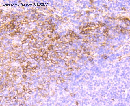 HUABIO ET1703-42-50UL image 2