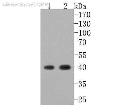 HUABIO ET1703-44 image 2