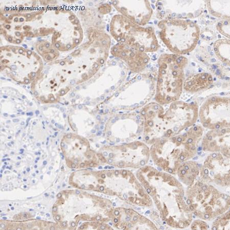 HUABIO ET1703-44 image 3