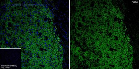 HUABIO ET1703-45 image 1