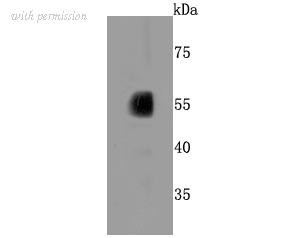 HUABIO ET1703-48 image 1