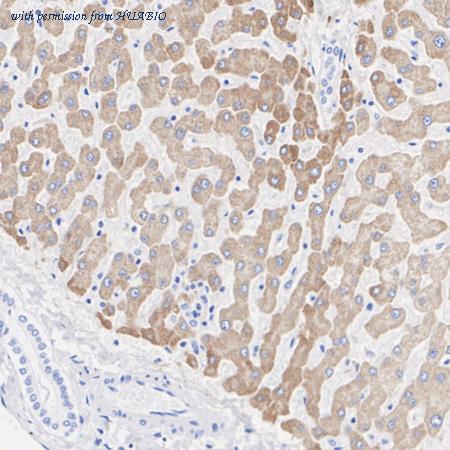 HUABIO ET1703-48 image 3