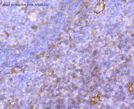 HUABIO ET1703-49 image 2