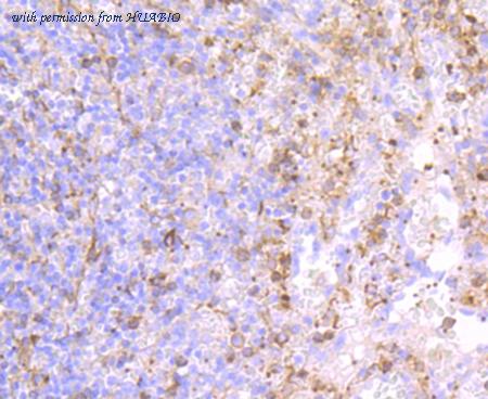 HUABIO ET1703-49 image 3