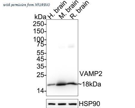 HUABIO ET1703-50 image 1