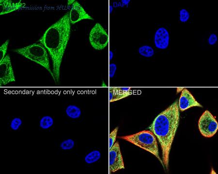 HUABIO ET1703-50 image 2