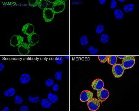 HUABIO ET1703-50 image 3